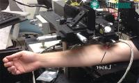 Ảnh Công nghệ dùng ánh sáng laser tiêu diệt tế bào ung thư hắc tố