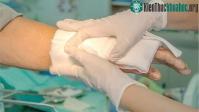Ảnh Cảm biến thông minh nghe được sự tiến triển của vết thương