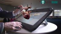 Ảnh Mô hình trái tim 3D giúp bác sĩ phẫu thuật thử trên bệnh thật