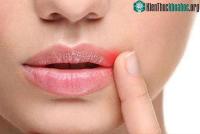 Ảnh Phát hiện đột phá về virus bệnh tình dục phổ biến nhất thế giới và cách chữa trị