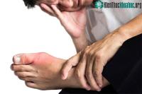 Ảnh Nguyên nhân gây bất ngờ khiến nhiều người dễ bị bệnh gout
