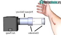 Ảnh Mỹ phát triển thiết bị phun sợi chứa thuốc băng bó vết thương