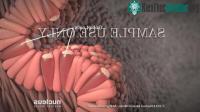 Ảnh Cận cảnh sự hình thành của loại ung thư bắt nguồn từ những thói quen ăn uống người Việt hay mắc phải