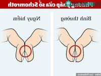 Ảnh Kiểm tra ngón tay có thể chẩn đoán bệnh ung thư phổi