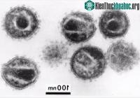 Ảnh Những sự thật ít người biết về virus: Chúng đã đến từ đâu, lây lan và gây bệnh như thế nào?