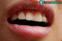 Ảnh Tại sao nhiều người lại bị khô miệng và đắng ngắt khi thức dậy vào buổi sáng?