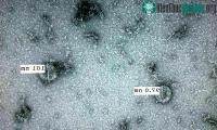Ảnh Vì sao không có thuốc đặc trị để tiêu diệt virus?