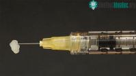 Ảnh Tạo ra loại gel có thể hàn gắn mọi vết thương trên cơ thể kể cả nội tạng