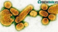 Ảnh Chuyện gì sẽ xảy xa khi tất cả virus biến mất?