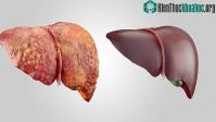 Ảnh Rượu tàn phá cơ thể người uống như thế nào?