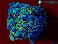 Ảnh Bệnh nhân đầu tiên trên thế giới khỏi HIV không cần điều trị