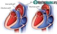 Ảnh Cách trái tim hoạt động và bơm máu đi khắp cơ thể