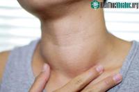 Ảnh Dấu hiệu cảnh báo cơ thể thiếu i-ốt, cần bổ sung ngay