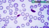 Ảnh Việt Nam chế tạo thành công 4 thiết bị test phát hiện ký sinh trùng sốt rét