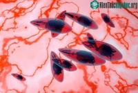 Ảnh Ký sinh trùng trong thịt chưa nấu chín có thể gây ra ung thư não