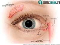 Ảnh Tuyến lệ nhân tạo khóc ra nước mắt thật trong ống nghiệm