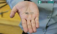 Ảnh Miếng dán truyền điện giúp cho xương gãy mau lành