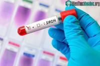 Ảnh 2 loại virus cúm gây ra tử vong ở người gần như đã tuyệt chủng