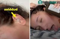 Ảnh Trào lưu nhỏ oxy già vào tai tiềm ẩn nguy hiểm trên TikTok