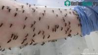 Ảnh Những thí nghiệm kỳ quặc và điên rồ nhất được các nhà khoa học thực hiện trên chính cơ thể mình