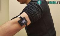 Ảnh Vai trò của  thiết bị cảm biến lactate có trong sinh lý học thể thao