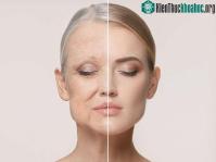Ảnh Phưng pháp có thể chống lại quá trình lão hóa