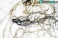 Ảnh Nghiên cứu phát triển rễ cây có khả năng dẫn điện của các  nhà khoa học Thụy Điển