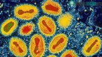 Ảnh Những loại virus gây bệnh dịch chết người từng "biến mất không dấu vết"