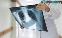 Ảnh Các nhà khoa học chế tạo thành công thiết bị dò tia X mỏng nhất thế giới