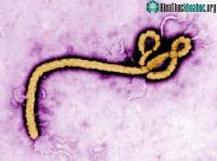 Ảnh Khám phá mới về loại virus làm cho 25-90% người nhiễm bệnh tử vong