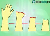Ảnh Liệu pháp tế bào gốc kết hợp với sóng âm có thể giúp xương gãy mọc trở lại