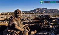 Ảnh Bác sĩ ngạc nhiên khi khám sức khỏe cho cụ ông '67 năm không tắm'