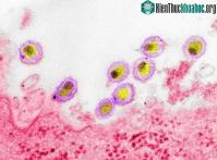 Ảnh Lời cảnh báo về đại dịch Covid-19 nhìn từ chủng HIV mới